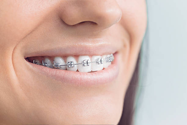 Full Mouth Reconstruction in Justice, OK